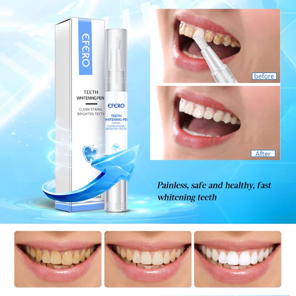 1+1 GRATIS | Brighten™ Zahnaufhellungsstift
